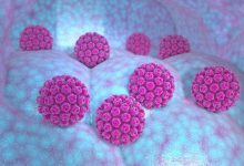 آیا نتیجه مثبت تست HPV به معنای ابتلای شما به سرطان دهانه رحم است؟