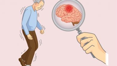 انتظاراتی که در مراحل میانی بیماری آلزایمر باید داشته باشید